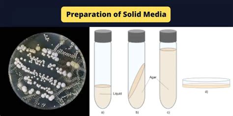 soft agar deep tests for what type of media|1.2: Media Preparation .